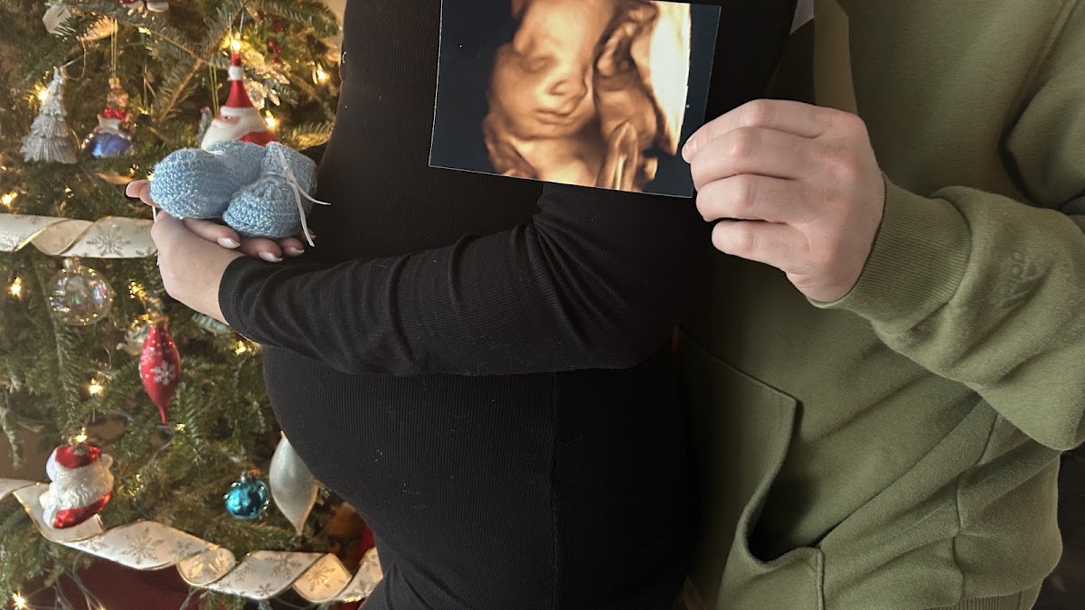 Wonderful Reveals 3D ultrasound & maternity & newborn Photography