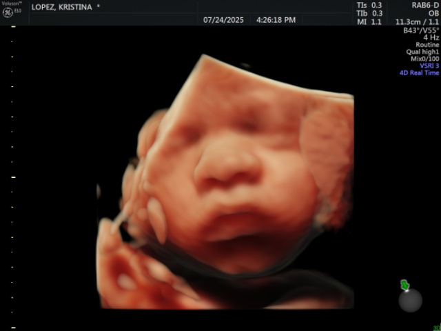 Baby in Blossom