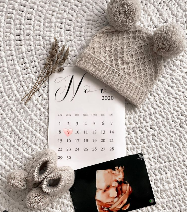 3D 4D Ultrasound Arizona in Phoenix