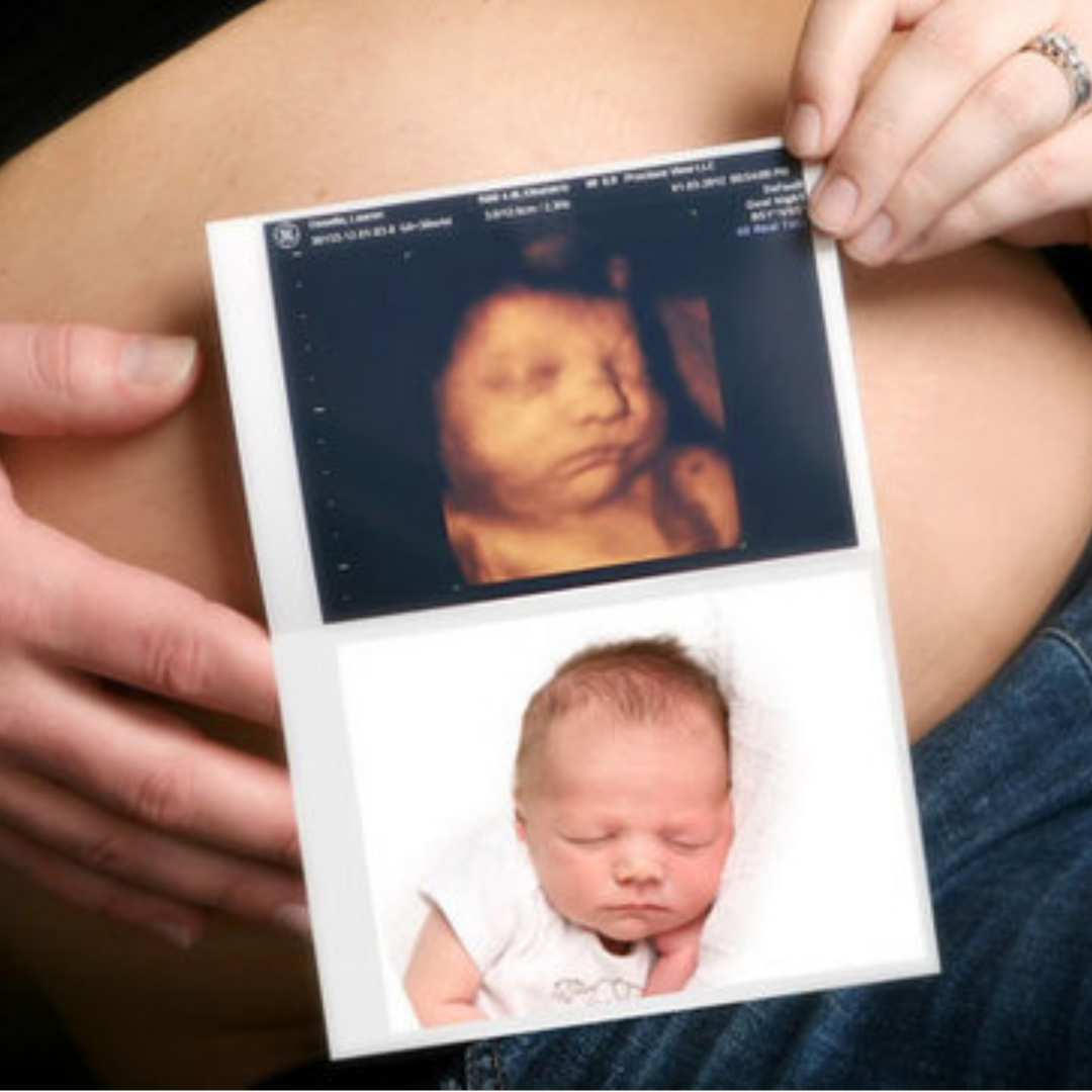 Phoenix 4D Ultrasound in Phoenix