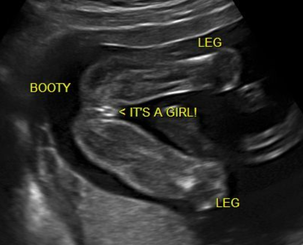 La Bella Belly Spa & Ultrasound Center