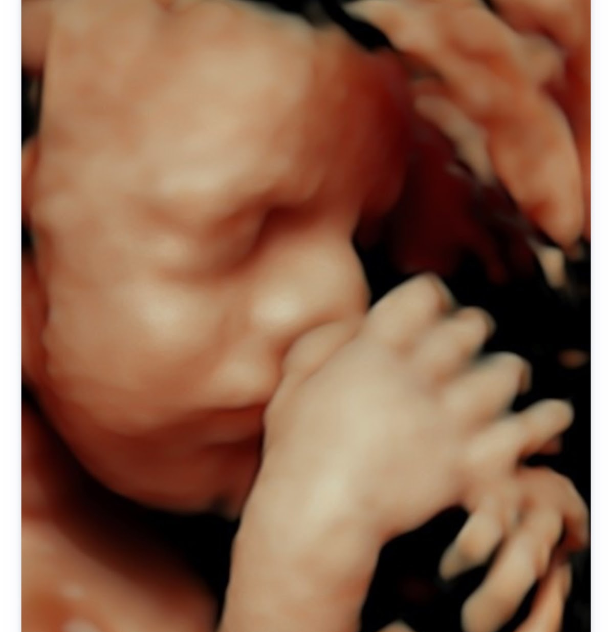 Cherished Memories Ultrasound
