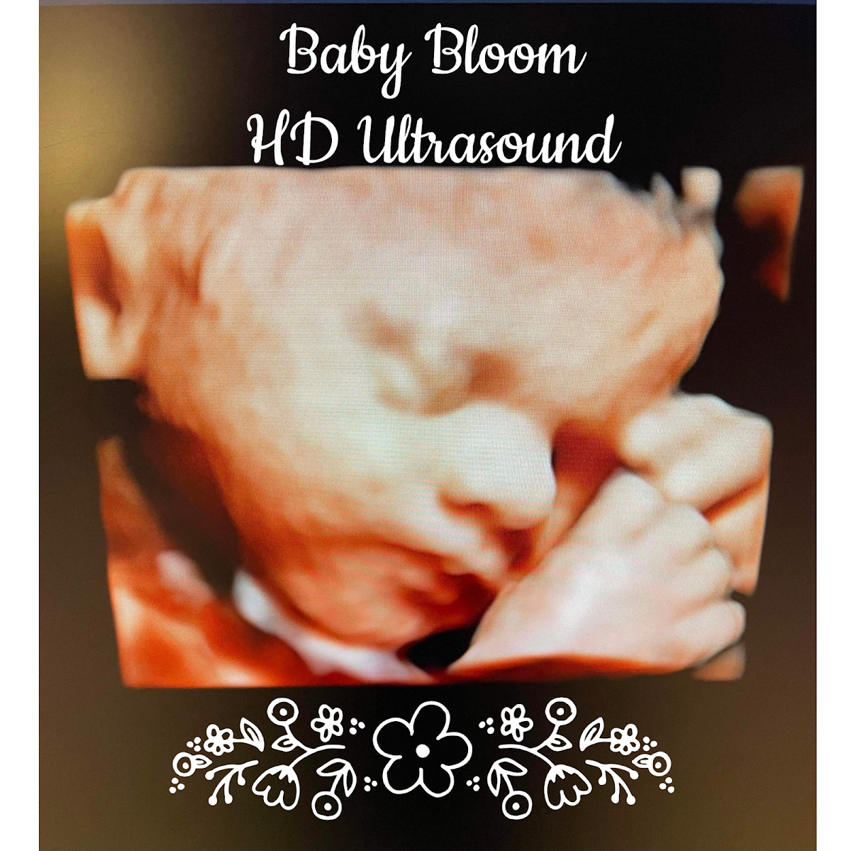 Baby Bloom 4D Ultrasound Studio cover