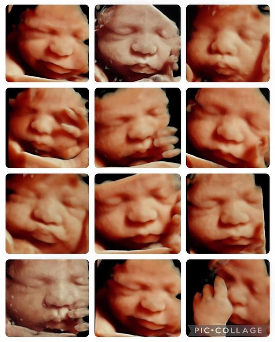 Goldenview Ultrasound 3d/4d/HD Chicago in Chicago