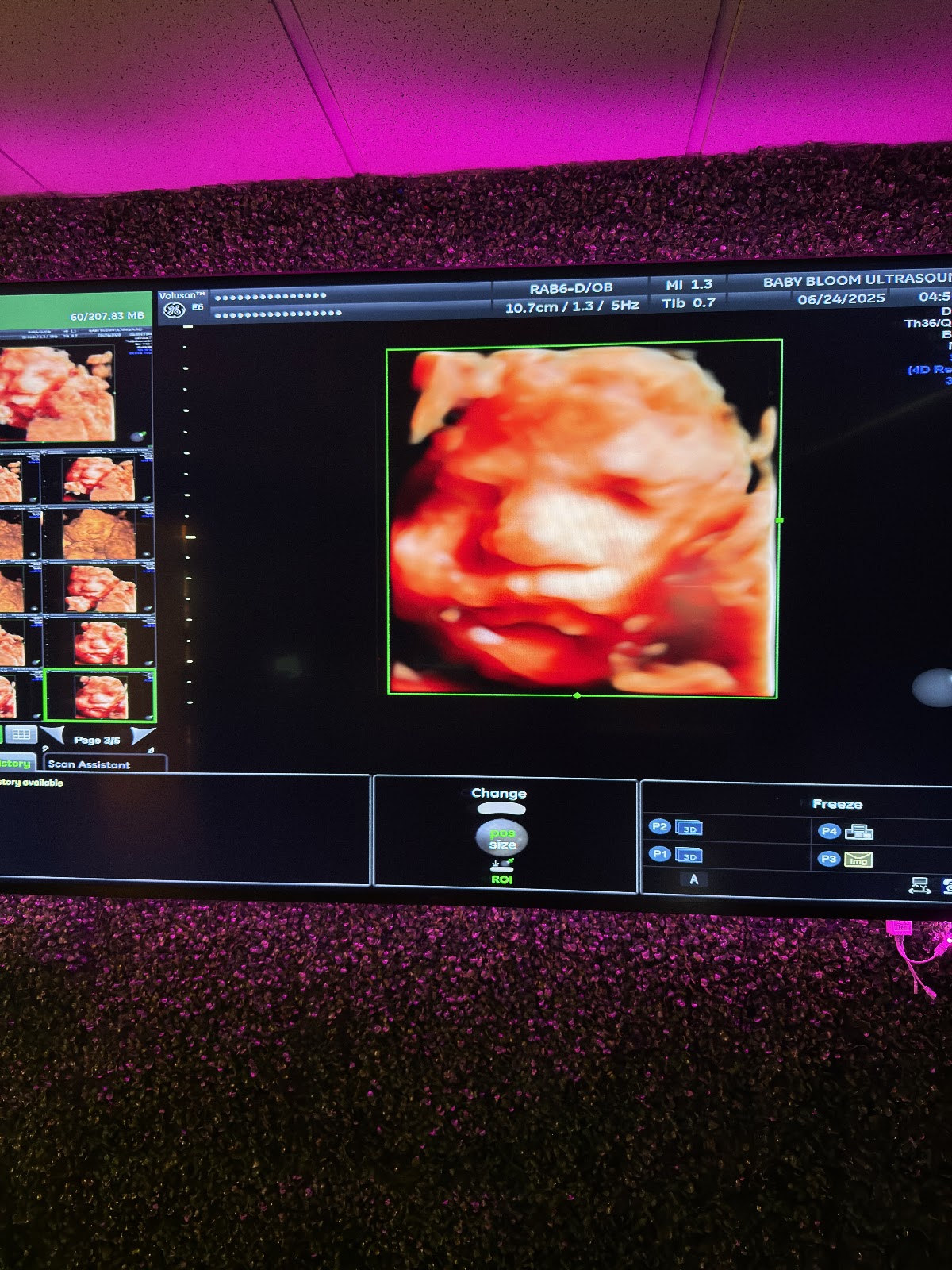 Baby Bloom Ultrasound Phoenix (Goodyear)