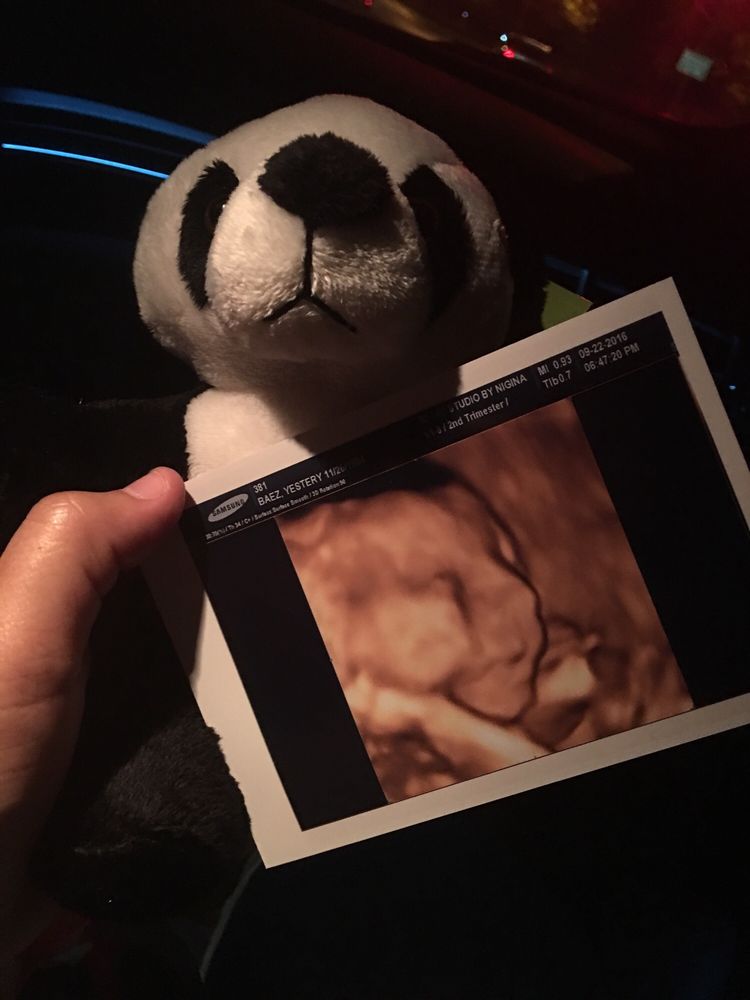 3D-4D Ultrasound Studio Queens