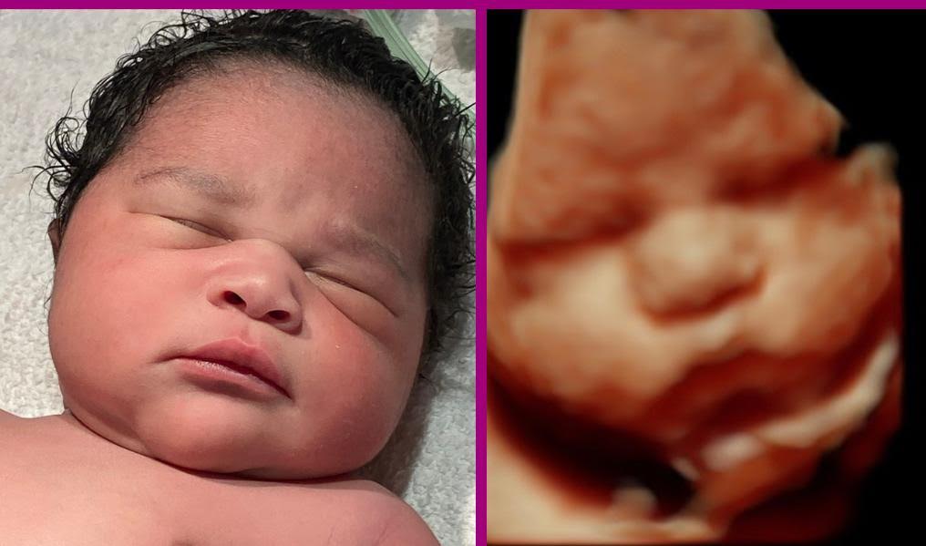 Miracle In Progress 3D/4D Ultrasound Studio
