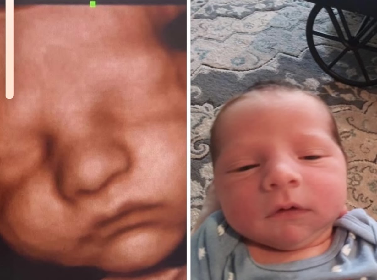 WR 3D/4D/5D ultrasound maternity & newborn photography cover