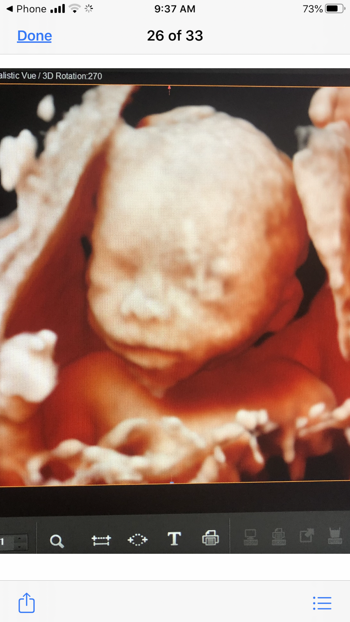 3D-4D Ultrasound Studio Queens