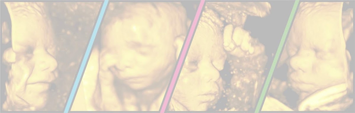 Sneak A Peek Imaging 3D 4D Ultrasounds Houston cover