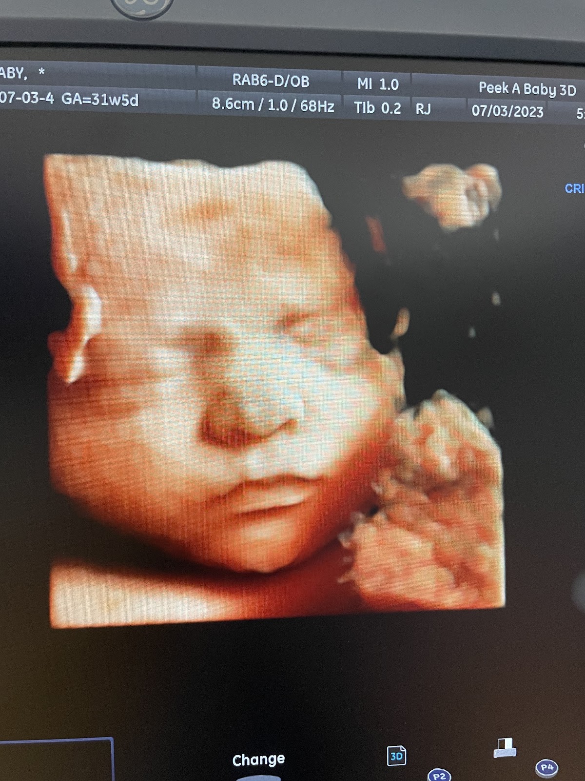 Peek A Baby 3D in Villa Park