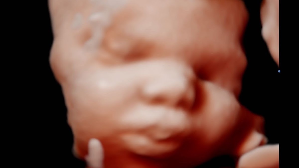 Forever Yours Ultrasound