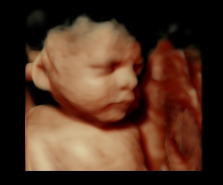 Cherished Memories 3D 4D Ultrasound cover