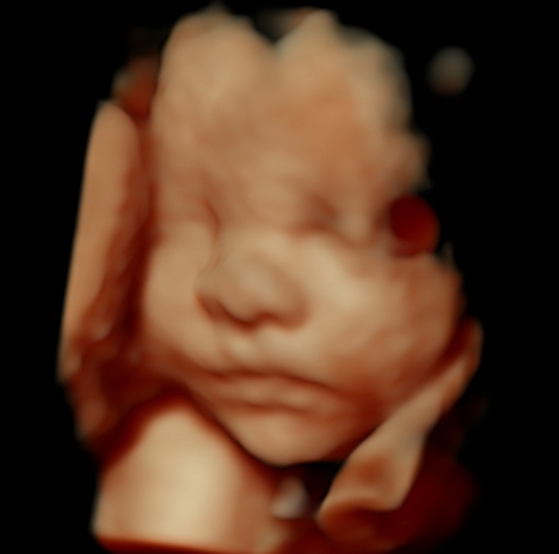 3D 4D HDLive Ultrasound - Cherished Memories cover