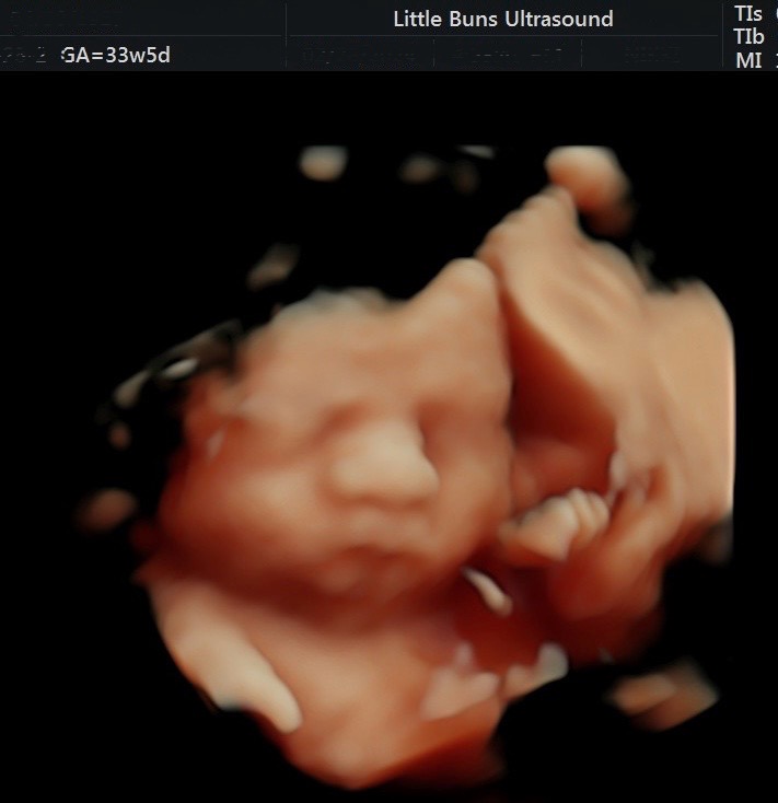 Little Buns Ultrasound And Baby Boutique