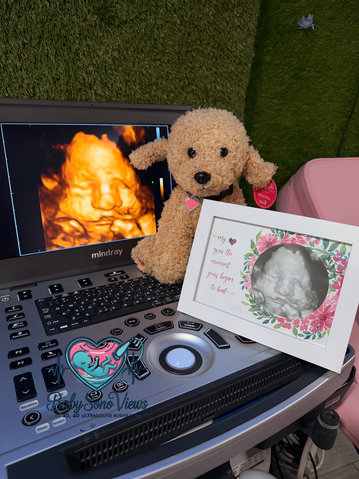 Baby Sono View's 3D/4D Ultrasound Studio