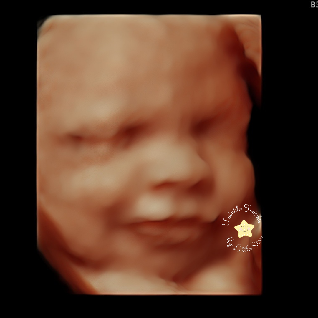 Twinkle Twinkle My Little Star Ultrasound cover