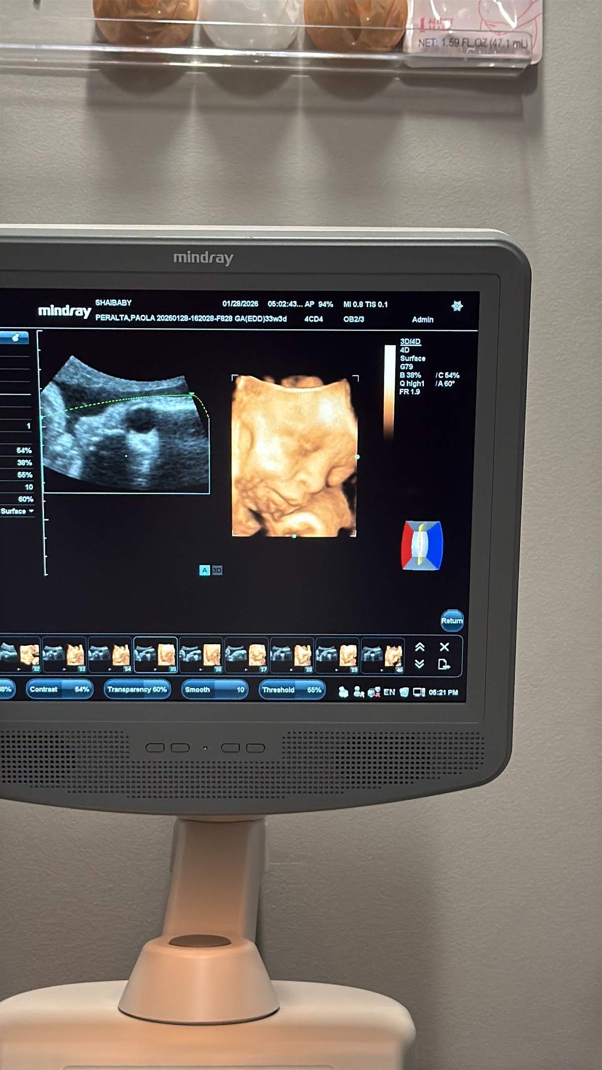ShaiBaby 3D4D Ultrasound - Same Day Appointments Available in Mableton