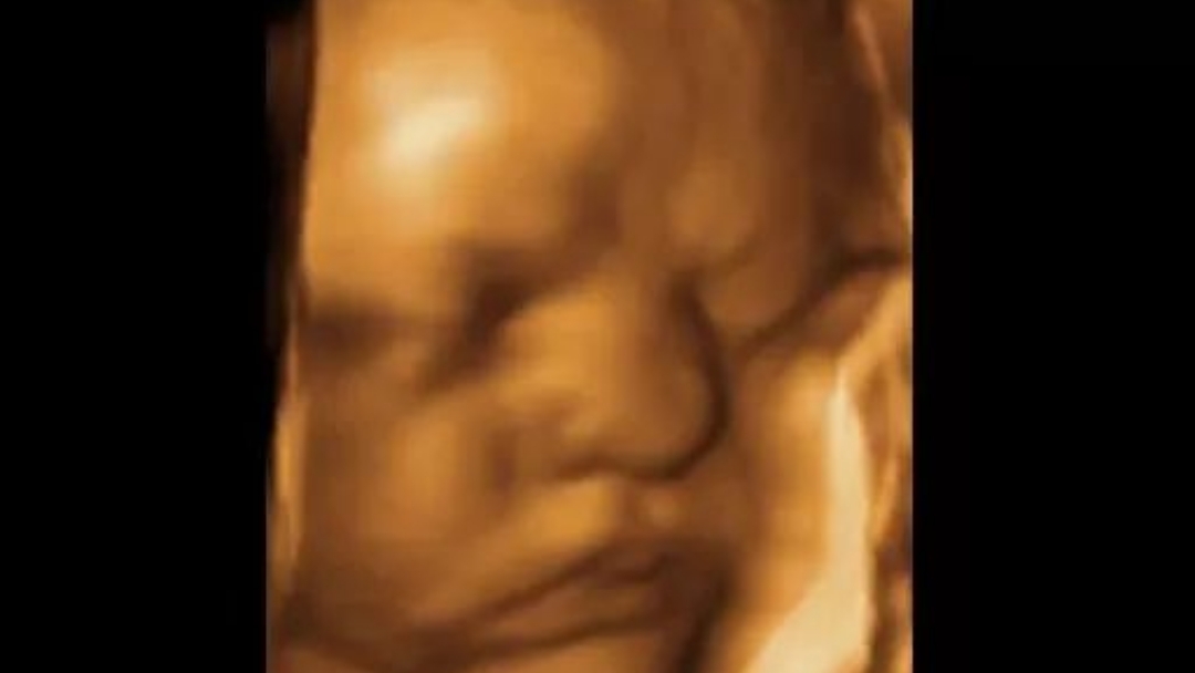 Fetal Memories 2D 3D 4D Ultrasound cover