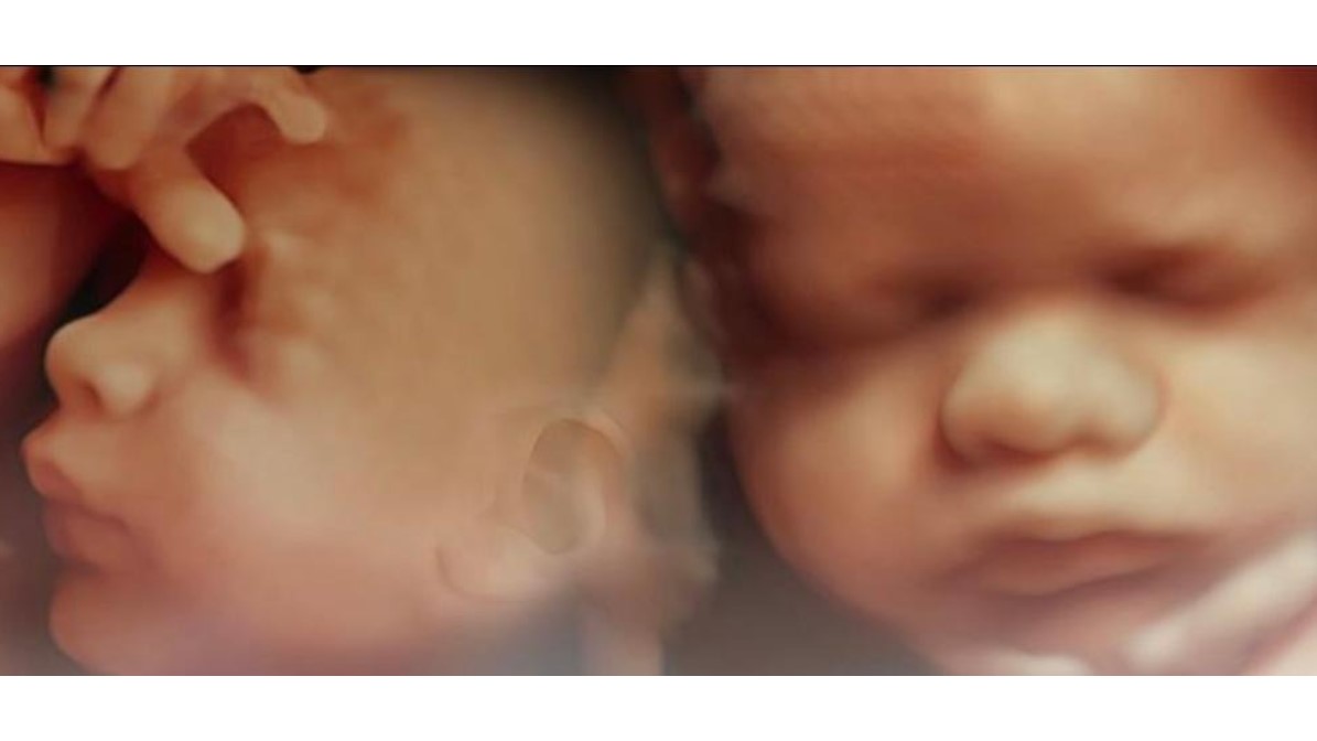 Maternity Imaging