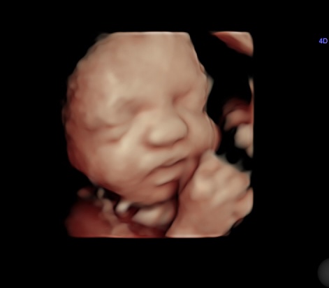 Desired Dream Ultrasound