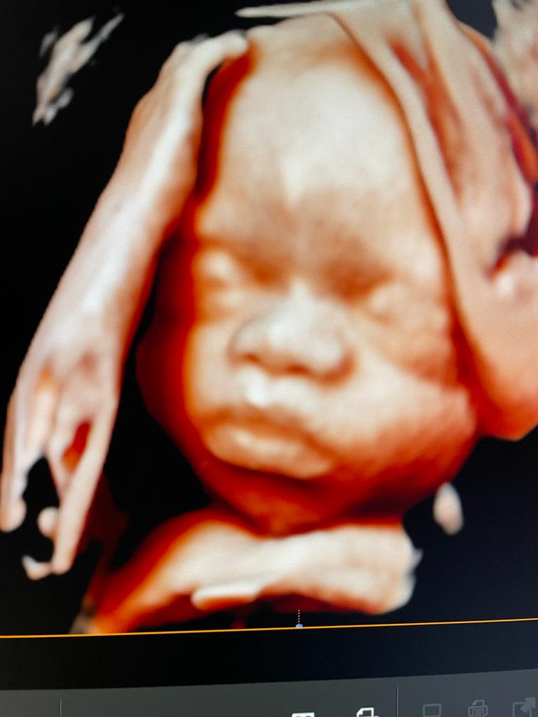 3D-4D Ultrasound Studio Brooklyn cover