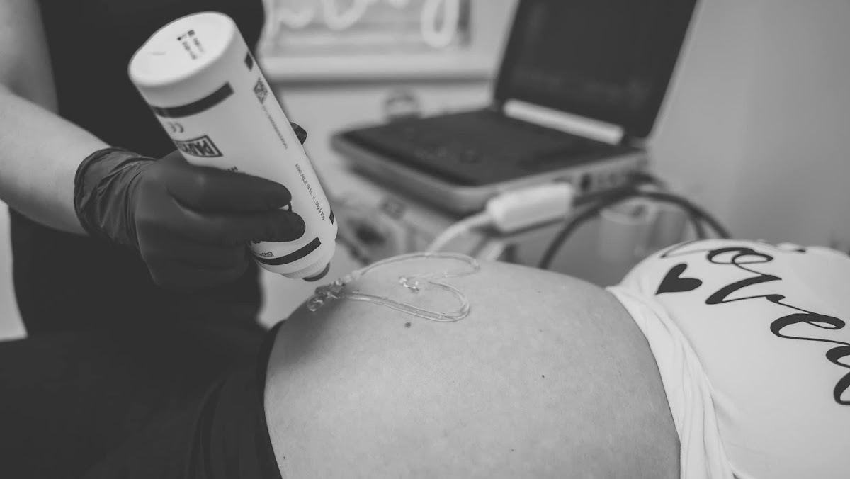 Baby Bee 3D Ultrasound (Fort Worth/NRH) cover