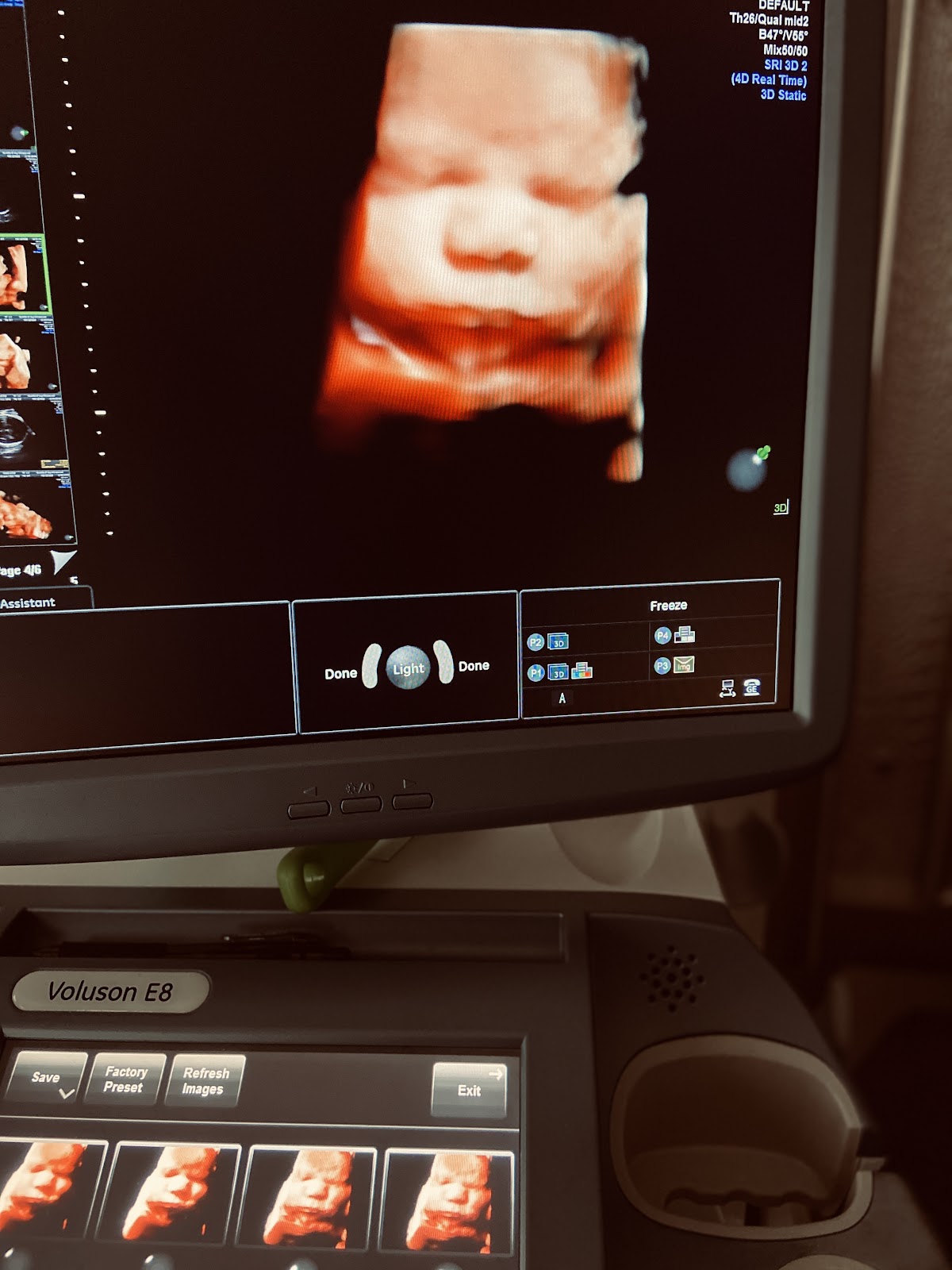 Bundle of Joy Ultrasound Studio in Chicago
