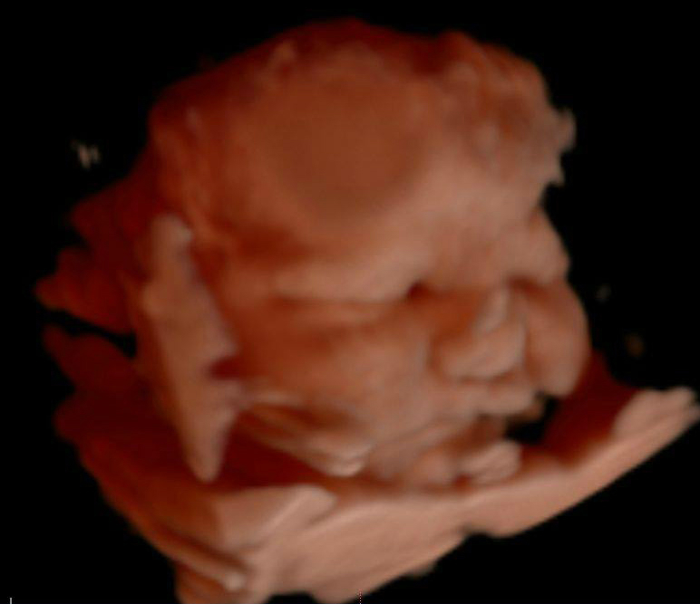 Keepsake Prenatal Imagaing 3D/4D HD Ultrasound Studio cover