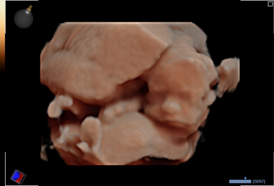 Precious Memories Ultrasound Imaging 3D/HD/4D