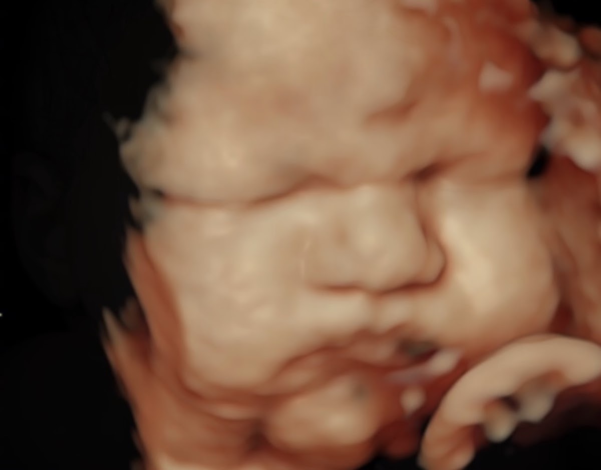 3D/4D Mother Goose Imaging Center cover