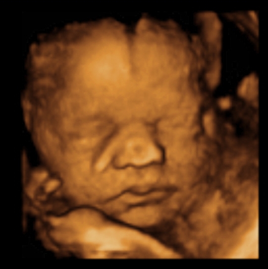 Sneak Peek Keepske Ultrasound, LLC cover