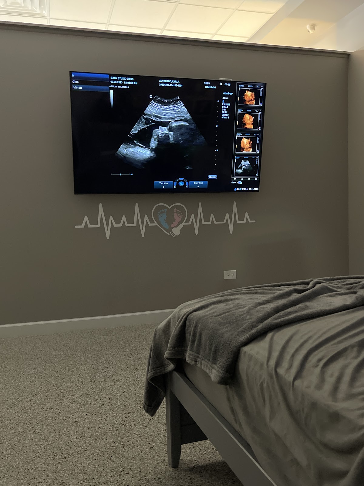 Baby Studio 3D/4D in Chicago