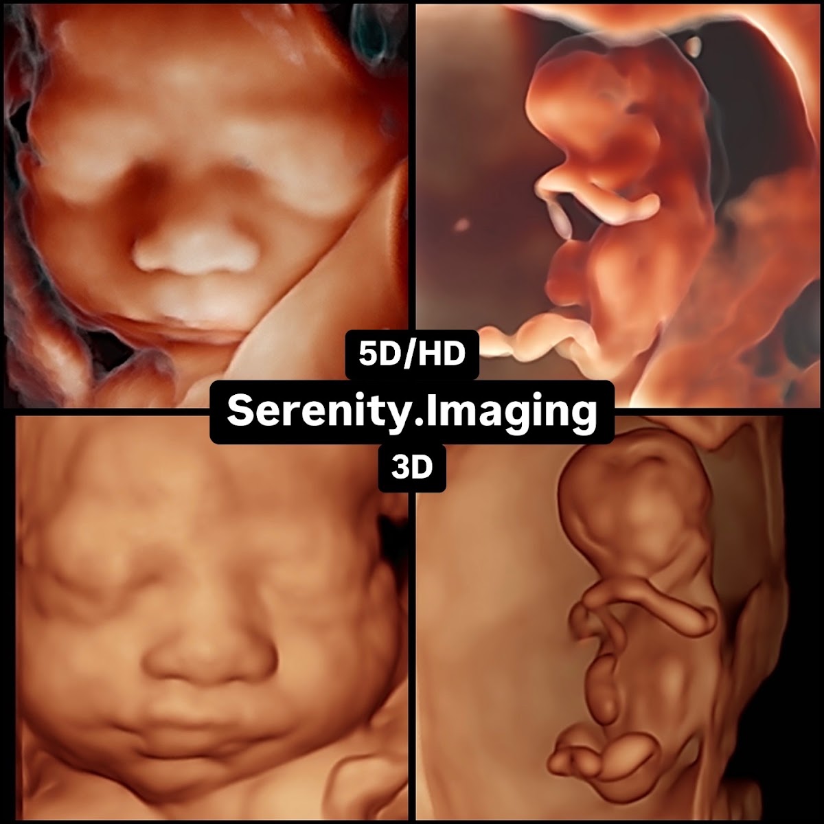 Serenity Imaging 3D/4D/5D Baby Ultrasound Studio
