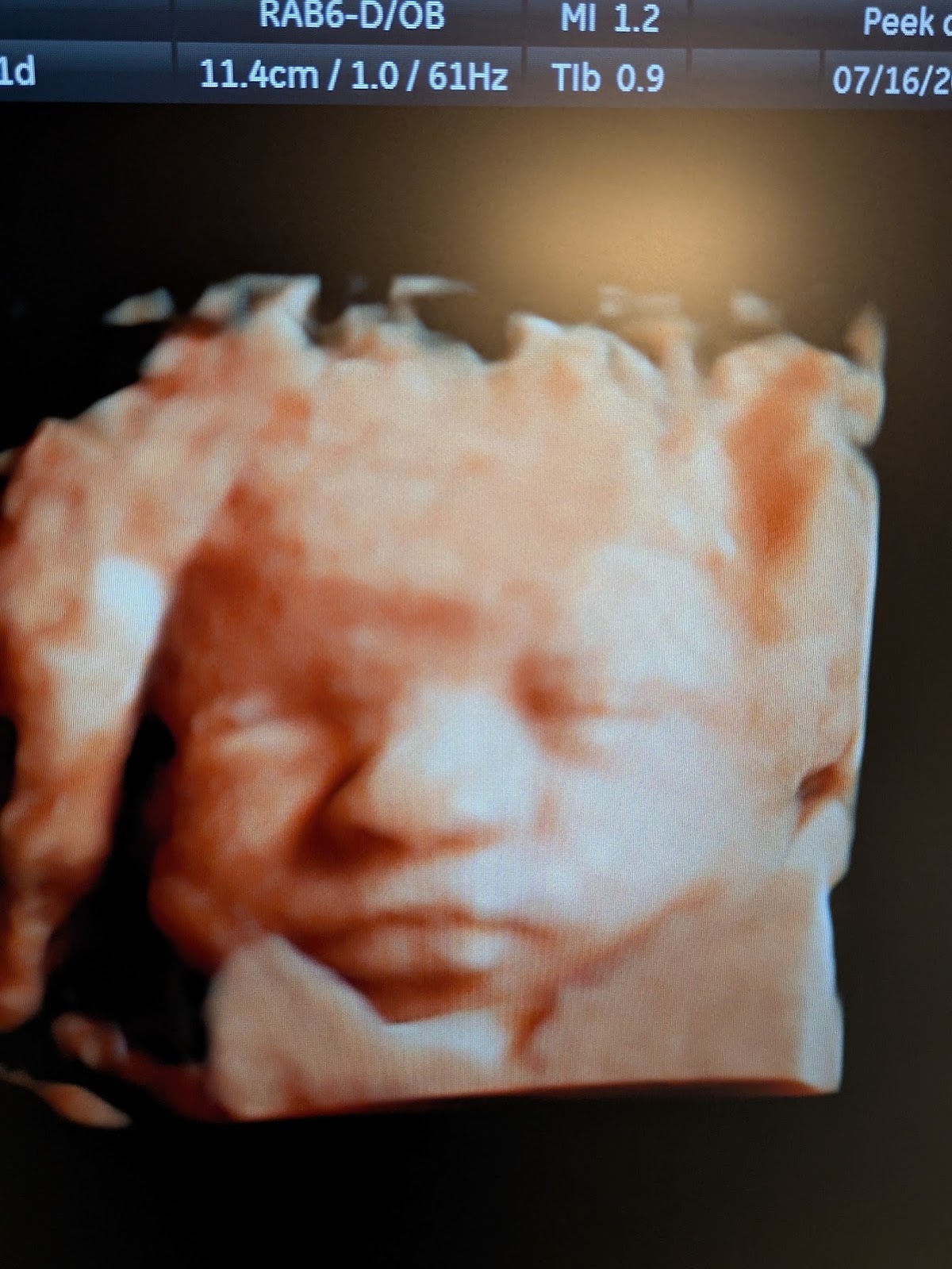 Peek a boo 3D Ultrasound in Suwanee