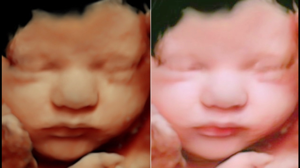 Your 4D Baby - 3D 4D & 5D Ultrasound