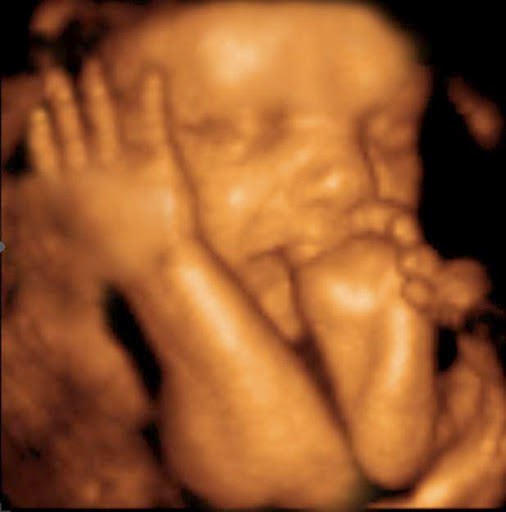 Peek a Belly 3D, Inc in Lockport