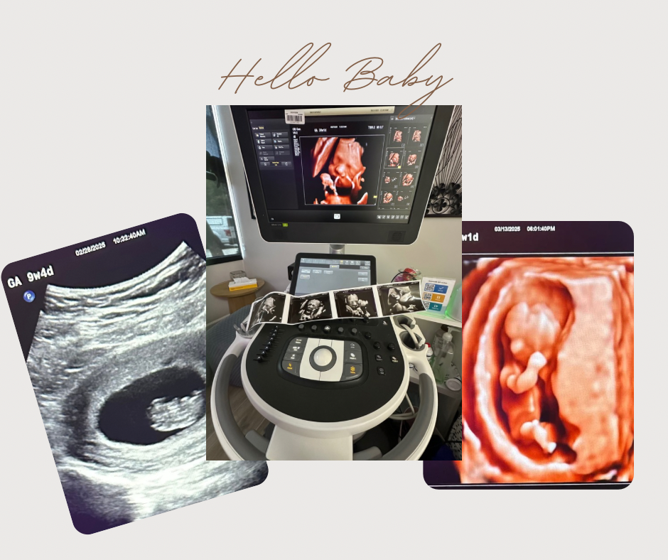 Cloud Baby Imaging 3D, 4D ultrasounds