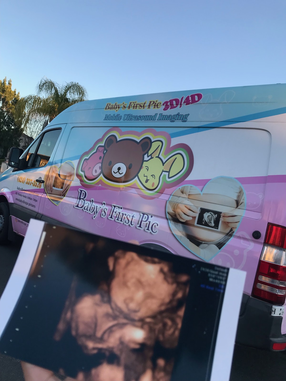 Baby's First Pic 3d4d ultrasound imaging