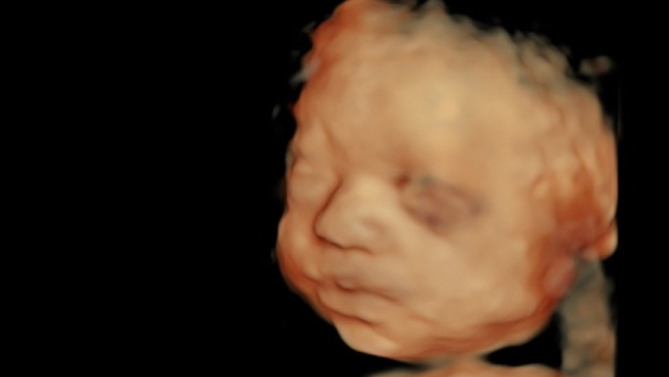 Haylo 3D Imaging