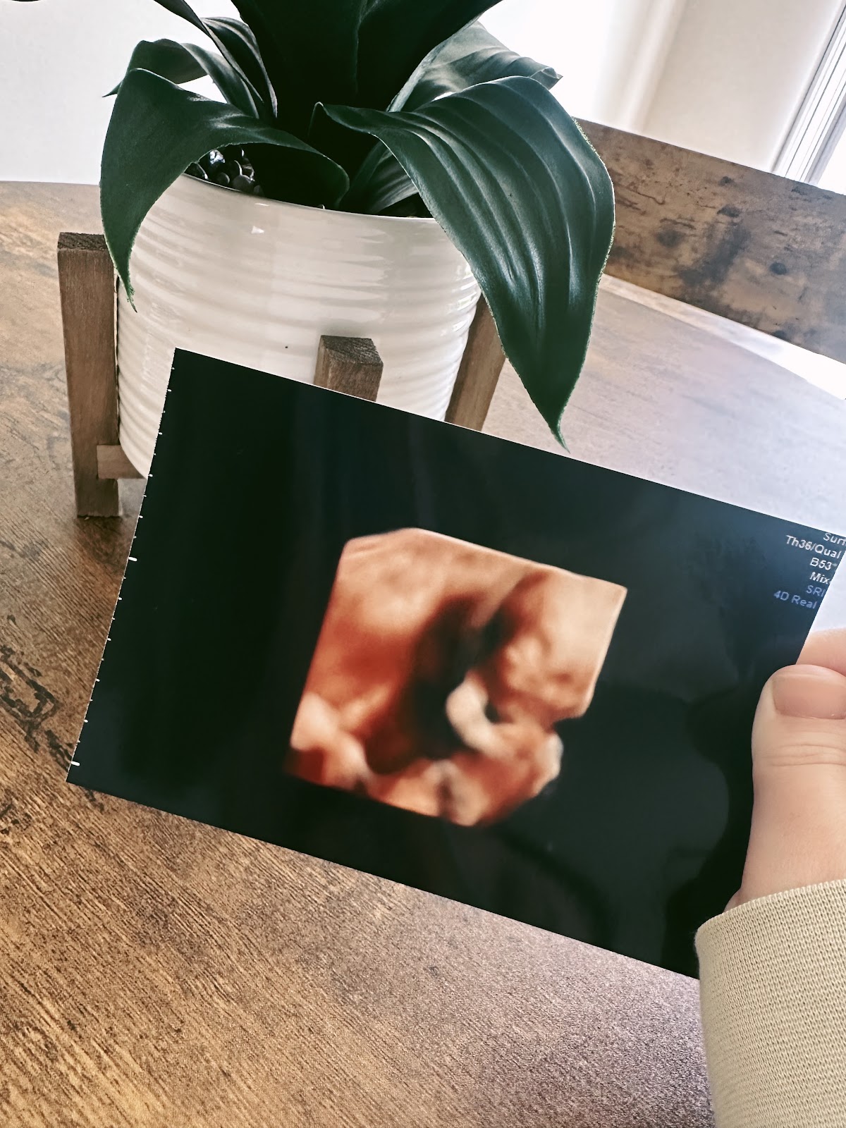 Gracious Gifts 3D/4D Ultrasound