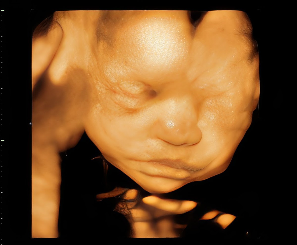 3D/4D Mini Baby Mae Ultrasound Image